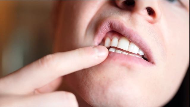 Sofort WEIßE ZÄHNE?! ? Zähne aufhellen zu Hause (Zahnbleaching Selbstexperiment) смотреть онлайн