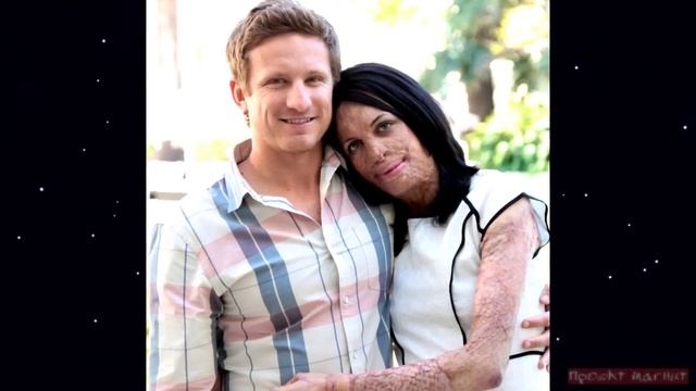 Модель после пожара смотреть онлайн