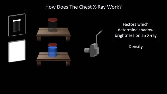 How to Interpret a Chest X-Ray (Lesson 1 - An Introduction) смотреть онлайн