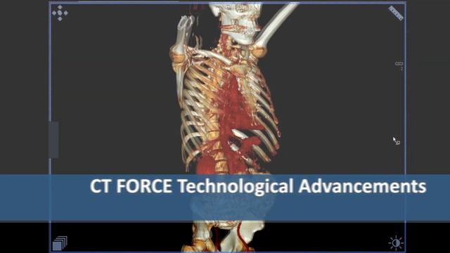 Shaare Zedek 2018 –Growth & Development смотреть онлайн