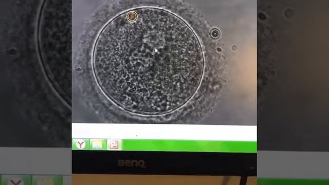 Оплодотворение 1 день смотреть онлайн