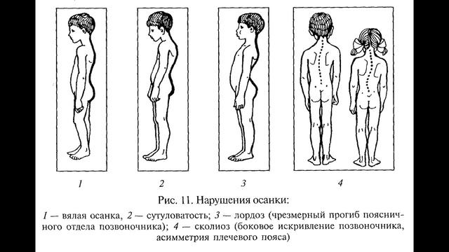Правильная осанка - это легко! Простые советы для здоровой и красивой спины смотреть онлайн