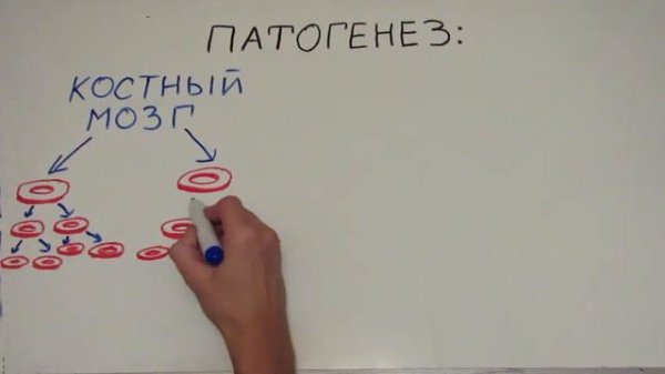 Болезнь Вакеза