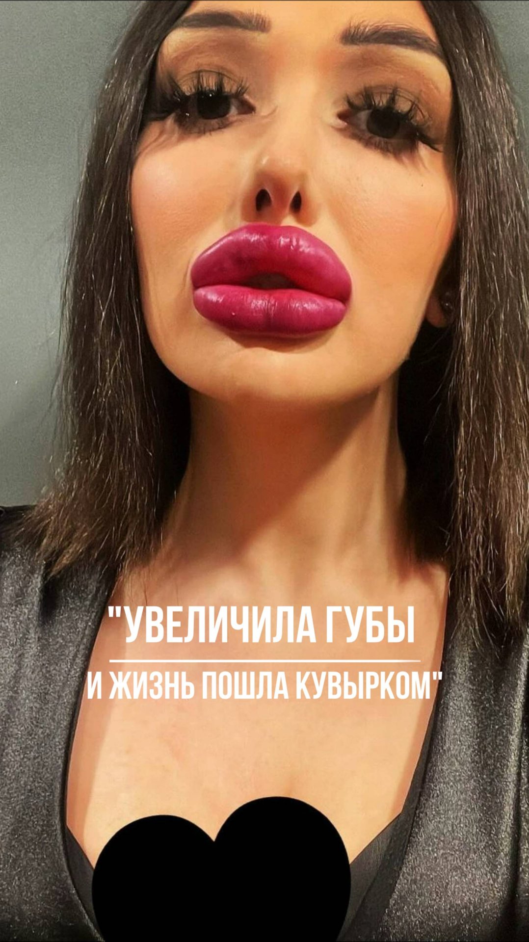 Увеличила губы и жизнь пошла кувырком смотреть онлайн