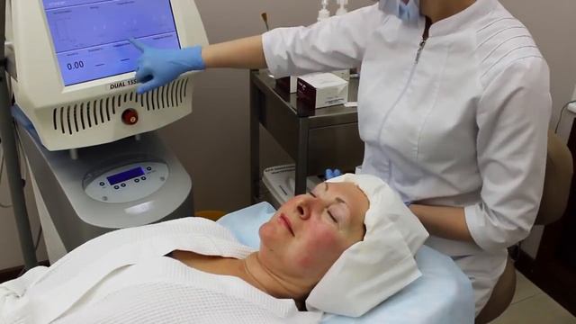Фраксель лазерная терапия кожи лица смотреть онлайн
