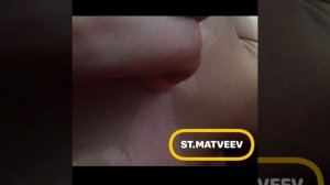Антистресс, снимаю кожу после загара.