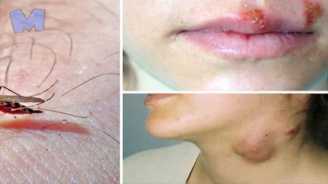 Самая древняя болезнь на земле смотреть онлайн