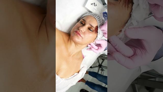 ПРОФИЛЬ ДЖОЛИ смотреть онлайн