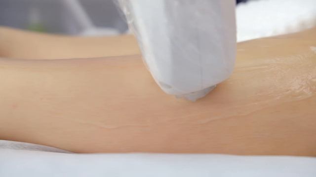 Лазерная эпиляция 2 смотреть онлайн