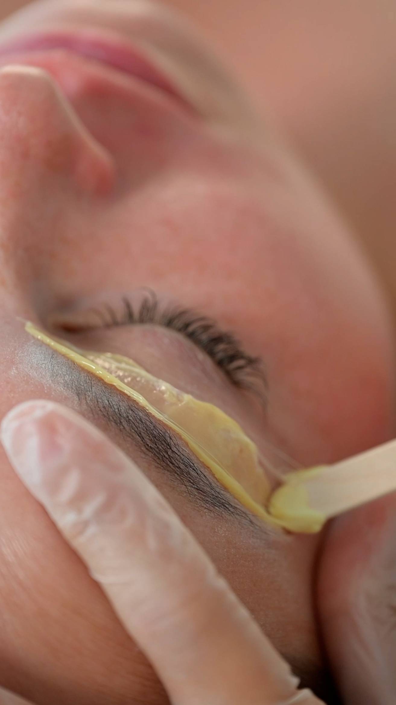 Депиляция волос на лице.