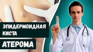 Атерома (киста сальной железы): краткая информация  Лечение. 2022