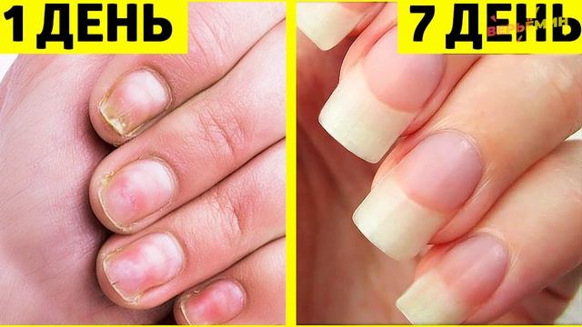 КАК ОТРАСТИТЬ КРЕПКИЕ НОГТИ ВСЕГО ЗА 7 ДНЕЙ смотреть онлайн