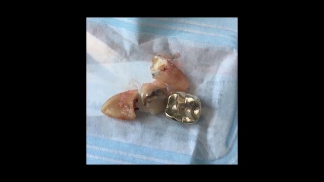 ЛИ ПРИСТ В РЕАНИМАЦИИ !!!!!NEW!!!! смотреть онлайн