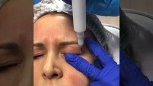 Холодная плазма - выбор грамотных специалистов ?