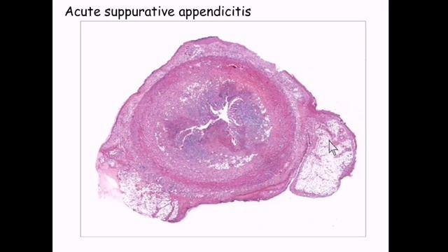 Pathology_practical_lec2_dr.dina смотреть онлайн