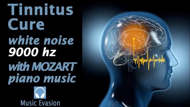 TINNITUS CURE WHITE NOISE 9000 Hz With MOZART PIANO MUSIC