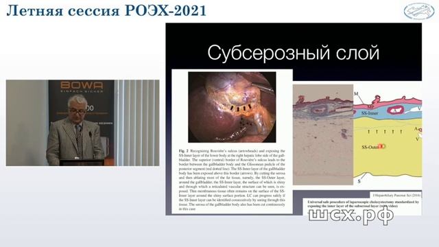 Безопасная холецистэктомия смотреть онлайн