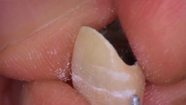 Dornelesatelierdental video 02 смотреть онлайн