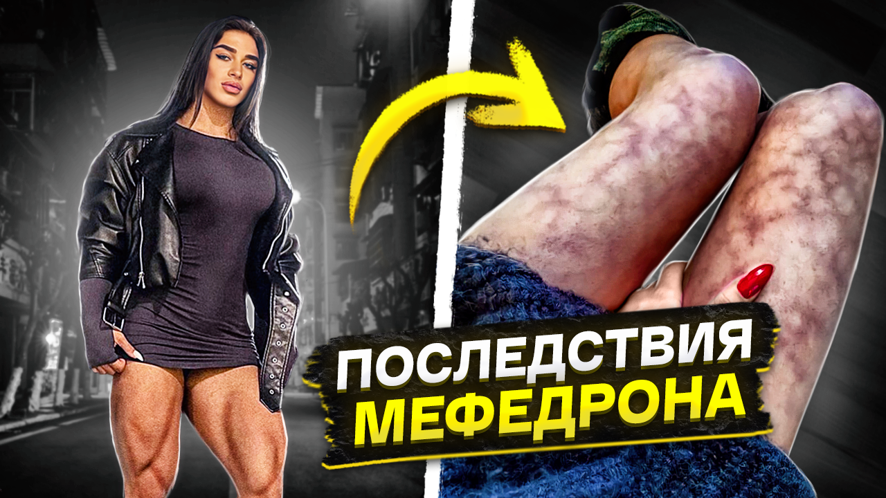 ПЛУЖНИКОВА / КУРС СТЕРОИДОВ и наркозависимость смотреть онлайн