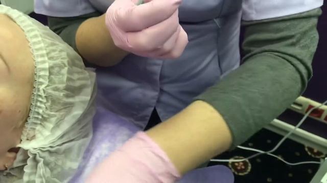 Дермаштамп в работе с флюидами Dr.Koжevatkin смотреть онлайн