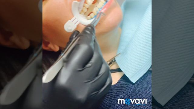 Отбеливание зубов Печерск смотреть онлайн