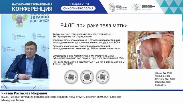 Исследование сторожевых лимфатических узлов в онкогинекологии: возможности радиозотопного метода. смотреть онлайн