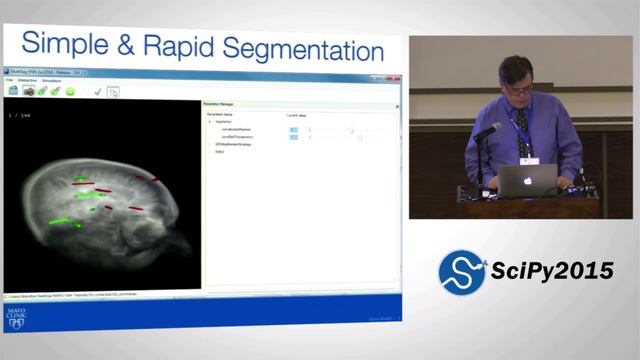 Rapid Accurate and Simple Segmentation of OBjects in Medical Images | SciPy 2015 | Ross Mitchell смотреть онлайн
