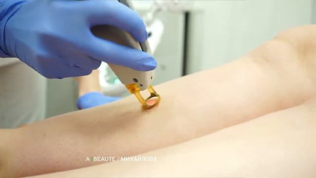 Лазерная эпиляция. Врач-косметолог Анна Михайловна Михайлова смотреть онлайн