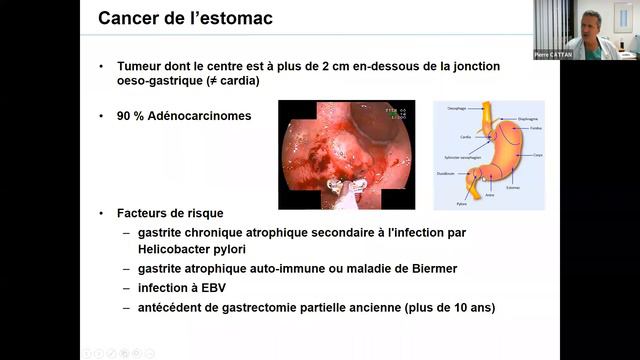 Séance 1 de formation sur la chirurgie digestive avec le Pr Pierre CATTAN, chirurgien digestif/Pari смотреть онлайн