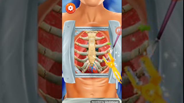 Играю в HEART SURGERY ER.Не судите меня не слышно. смотреть онлайн