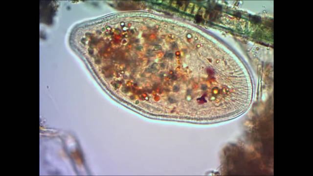 Инфузория туфелька под микроскопом under microscope смотреть онлайн