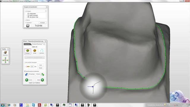 simedaCAD (exoCAD) BRIDGE- 3elements смотреть онлайн