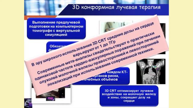 Проблемы сердечно-сосудистых осложнений, индуцированных лучевой терапией смотреть онлайн