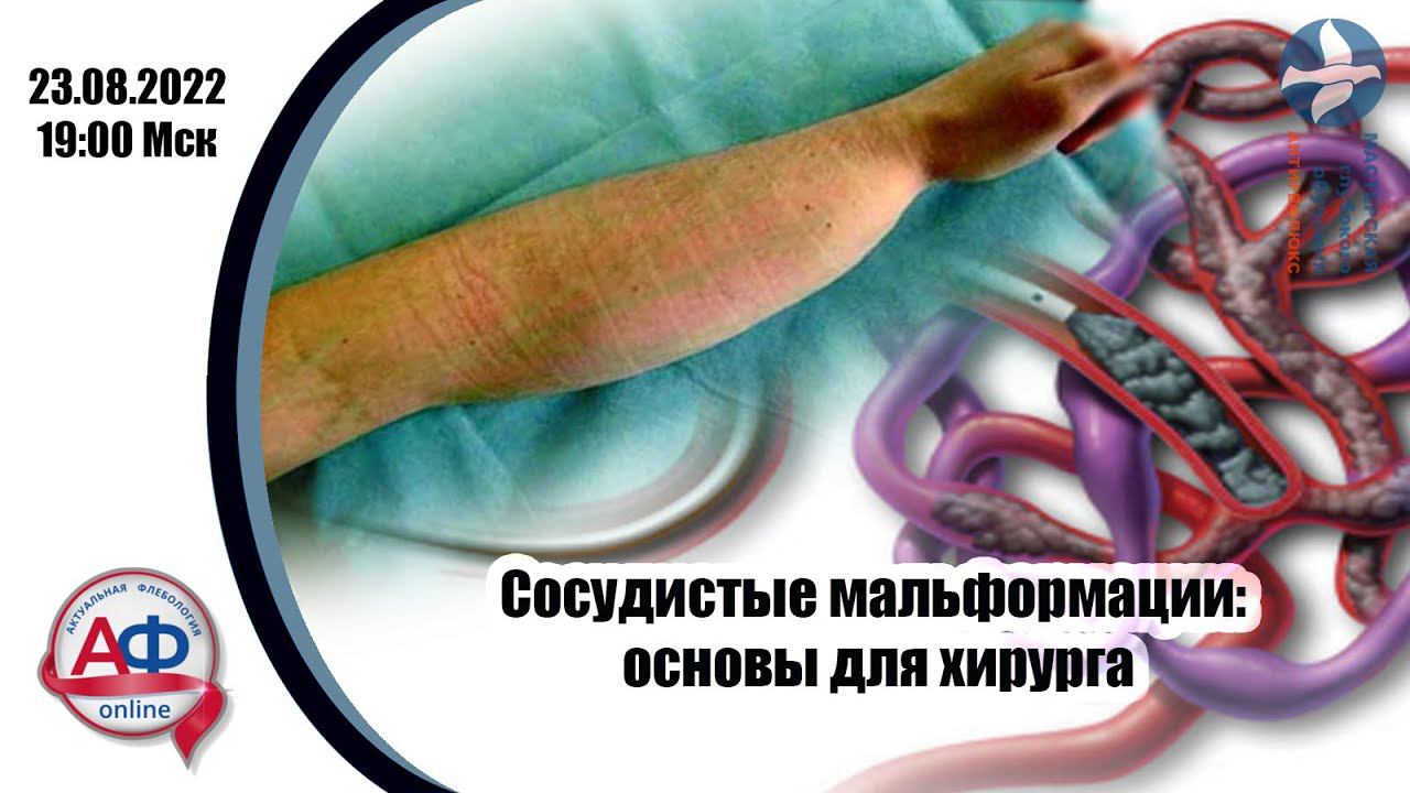 Сосудистые мальформации: основы для хирурга смотреть онлайн
