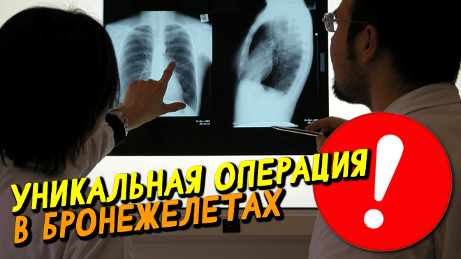 Граната застряла не разорвавшись ❗ В бронежилетах: Врачи провели УНИКАЛЬНУЮ ОПЕРАЦИЮ смотреть онлайн