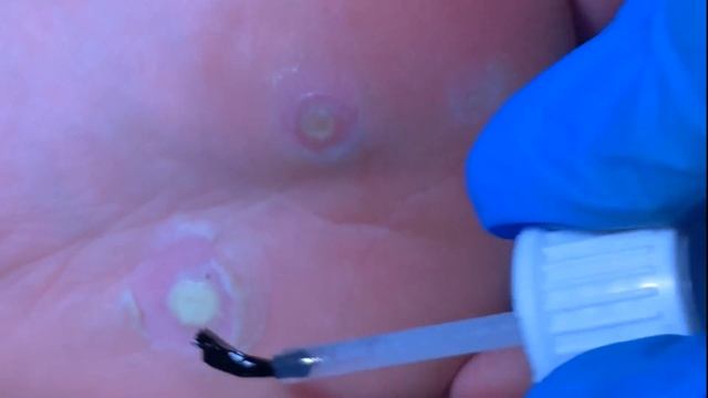 Уход за лицом: чистка и лифтинг