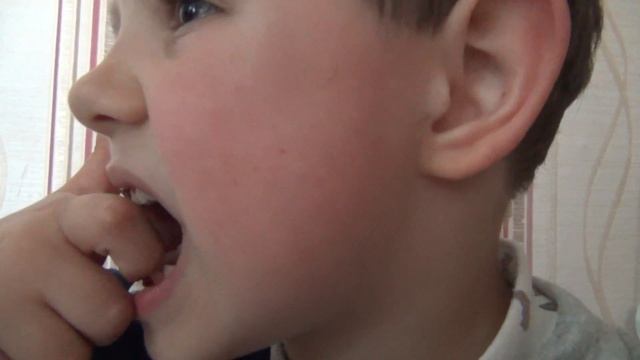 Сам себе удалил зуб смотреть онлайн