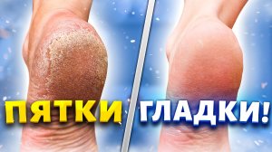 Пяточки как у младенца! Как сделать пятки гладкими в домашних условиях. Пилинг для ног своими руками