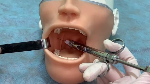 Торусальная анестезия смотреть онлайн