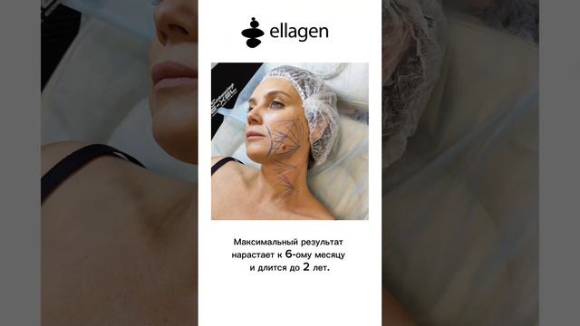 препарат ELLAGEN от компании APTOS