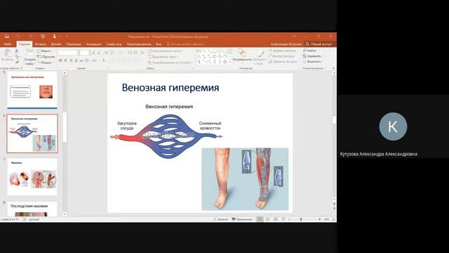 Нарушения периферического кровообращения