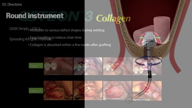 Sinus concept with DASK Simple смотреть онлайн