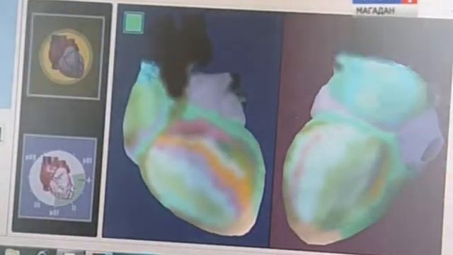 Медосмотры в общеобразовательных учреждениях Магадана смотреть онлайн