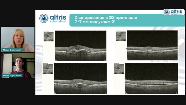 Оптическая когерентная томография: обзор протоколов исследования смотреть онлайн