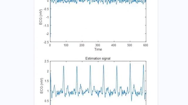 one-dimensional signal denoising algorithm based on adaptive filtering least mean square algorithm смотреть онлайн