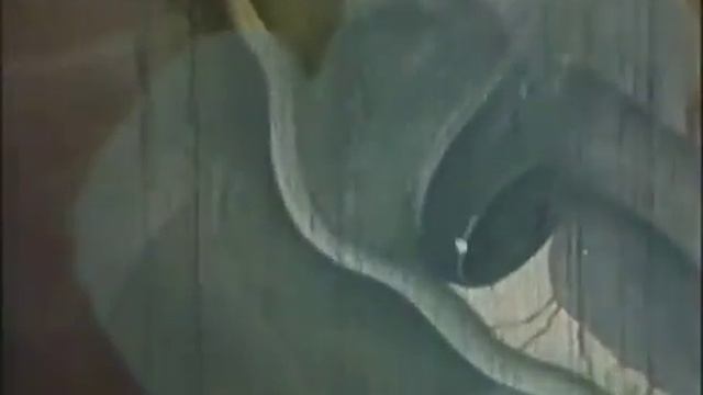 Аппендицит, аппендэктомия смотреть онлайн