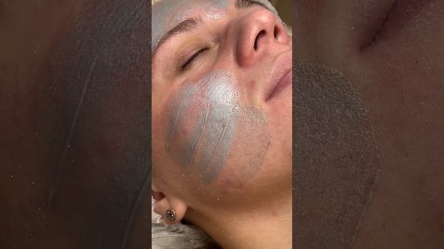 Клиника VALLISTEP Кострома , уход GIGI смотреть онлайн