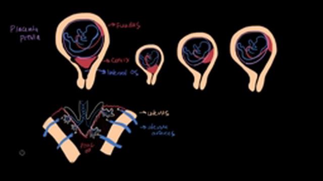 Placenta previa смотреть онлайн