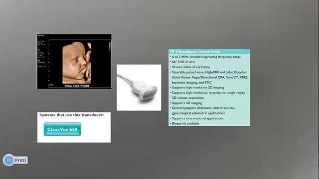 PHILIPS Clearvue 650 ultrasound смотреть онлайн