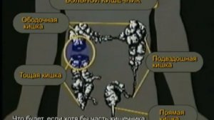 ⚡СМЕРТЬ ПРИТАИЛАСЬ В ТОЛСТОЙ  КИШКЕ